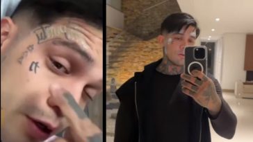 yeferson cossio retirara tatuajes rostro