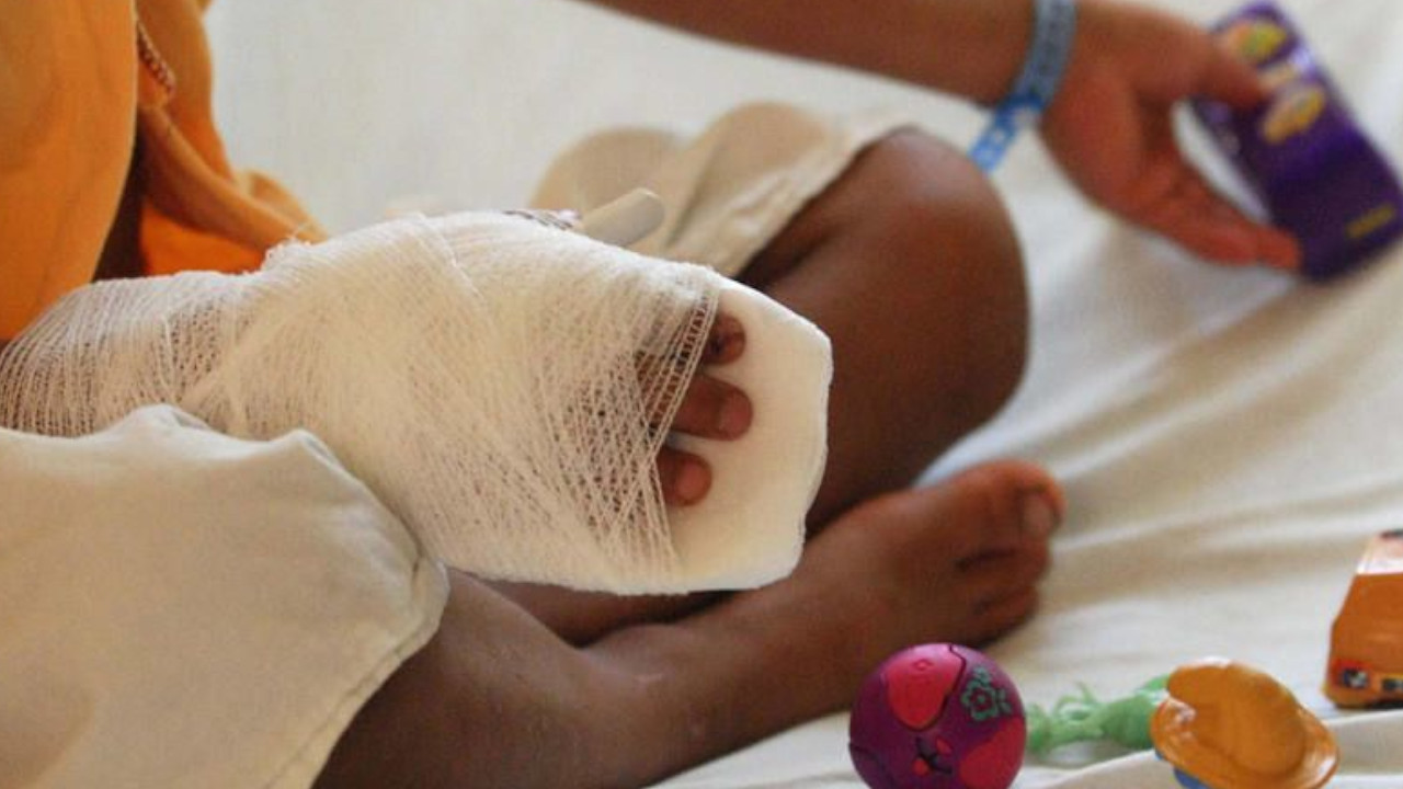 ¿Cuántos quemados por pólvora registran este 17 de diciembre?