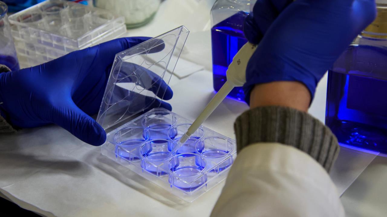 Prosigue ensayo con fármaco contra el cáncer de páncreas tras buenos resultados