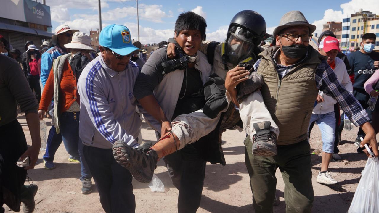 El fotógrafo de EFE Aldair Mejía, herido mientras cubría protestas en Perú