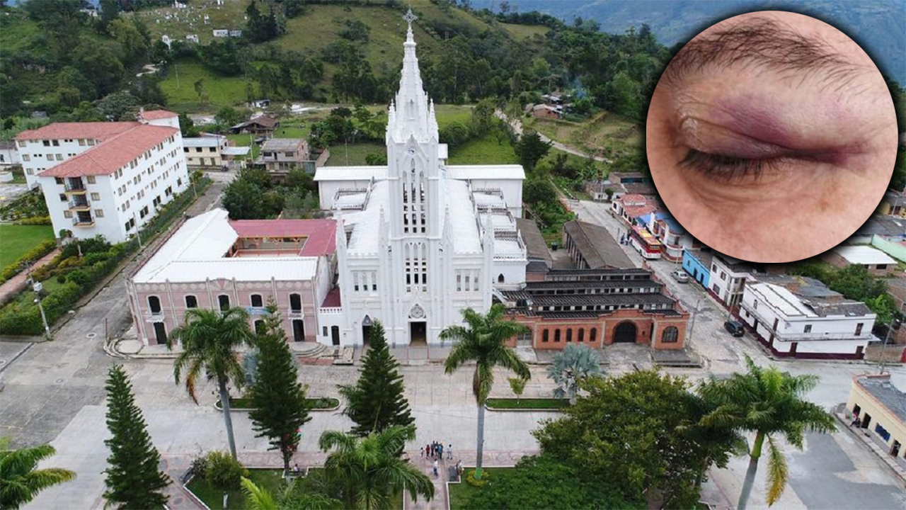 Profesora fue golpeada por el alcalde de San Jose de Miranda Santander
