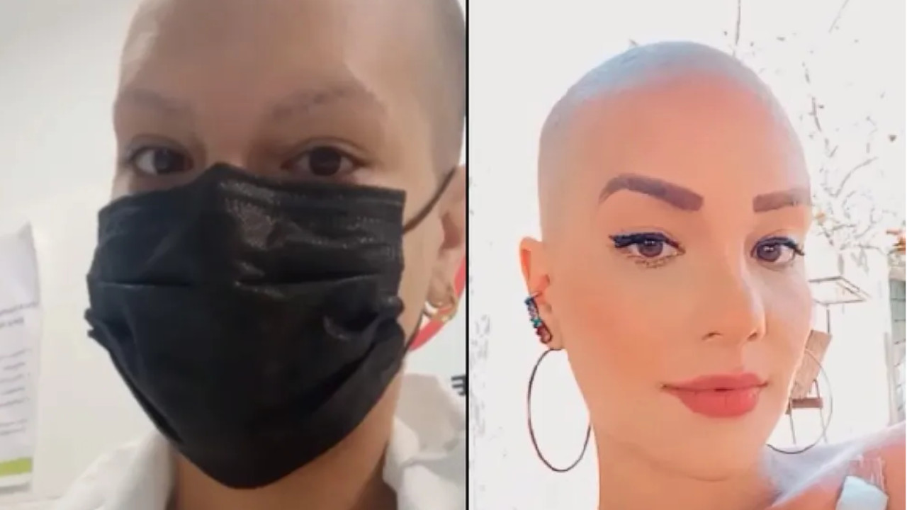 ¡Increíble! Brasileña fingió tener cáncer de mama para pedir dinero