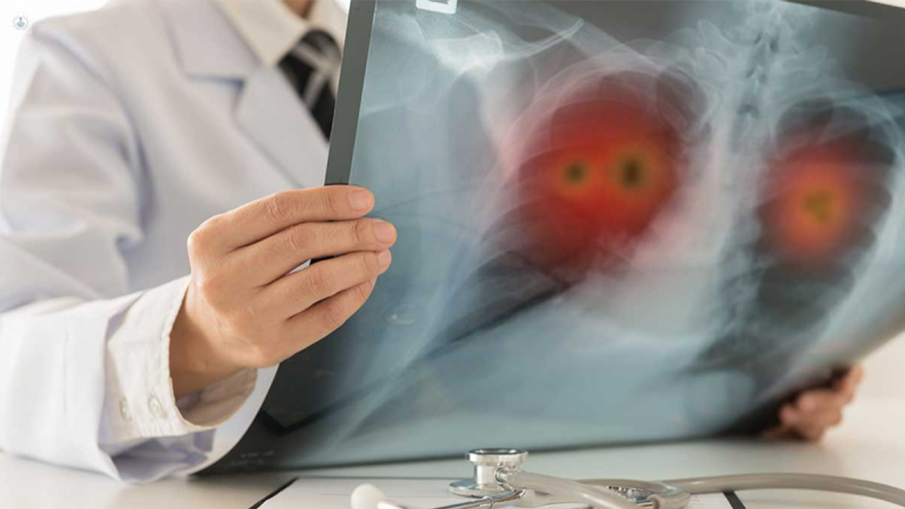 ¡Terrible equivocación! Por enviar mensaje navideño, hospital diagnosticó cáncer a cientos de pacientes