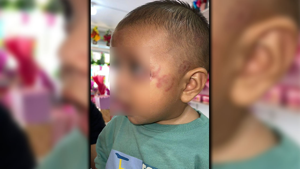[VIDEO] Un pequeñito fue mordido en una guardería en Turbo, Antioquia