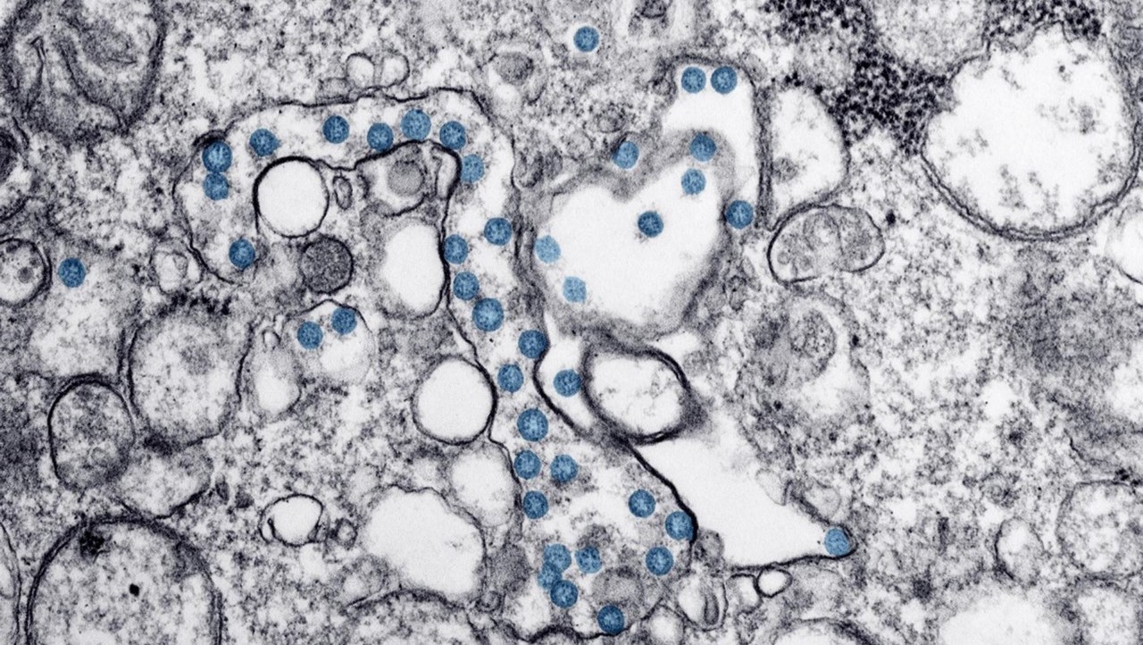 El coronavirus tiene capacidad de provocar un envejecimiento acelerado