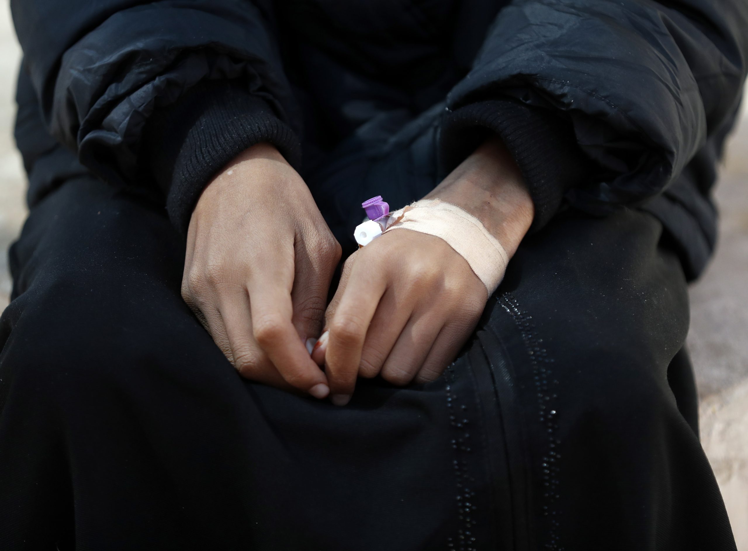 El trasplante de células madre antes de la inmunoterapia, clave en el cáncer infantil