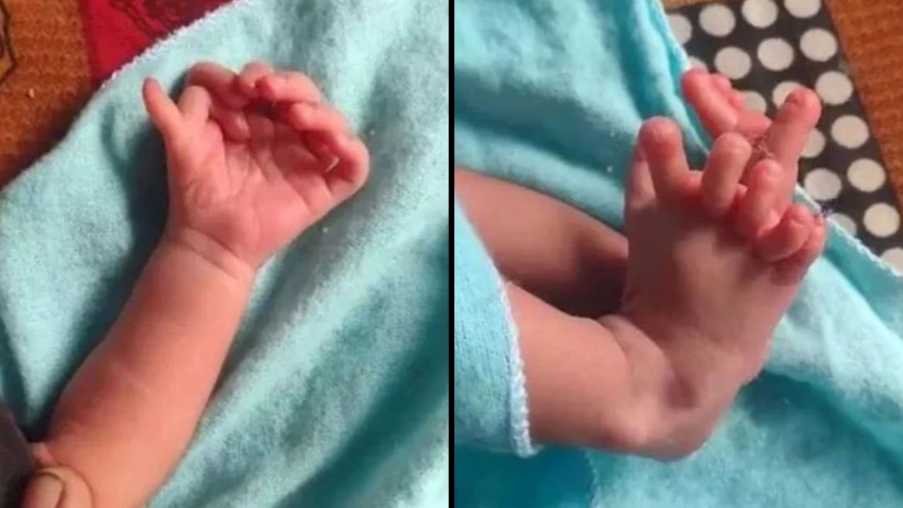 Bebé nació con 26 dedos y sus padres dicen que podría ser la reencarnación de una diosa
