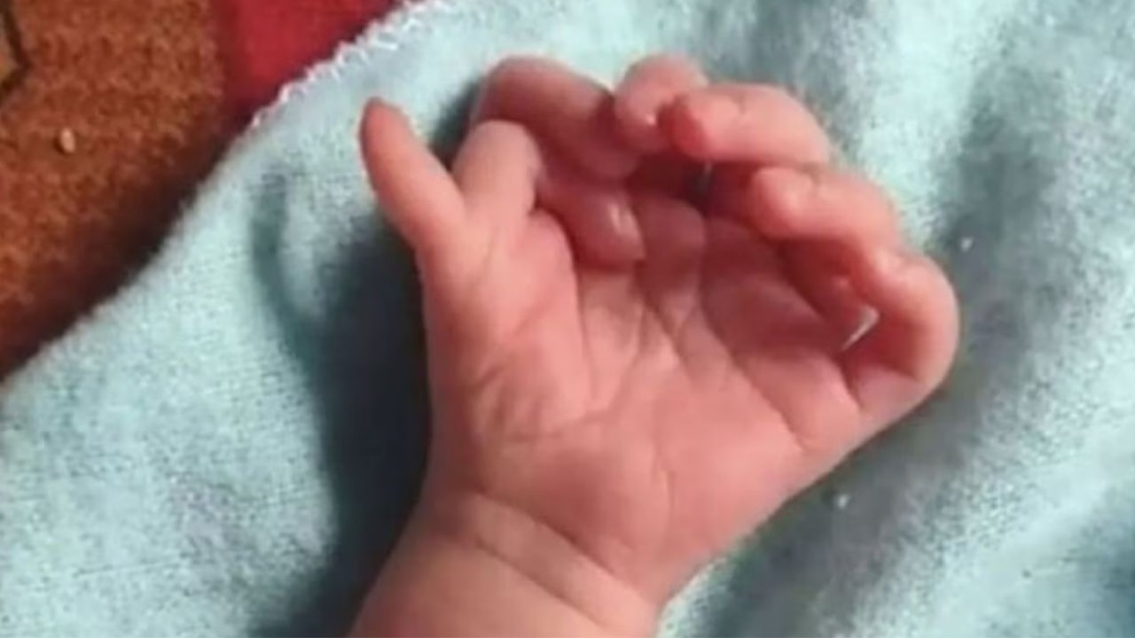 Bebé nació con 26 dedos y sus padres dicen que podría ser la reencarnación de una diosa