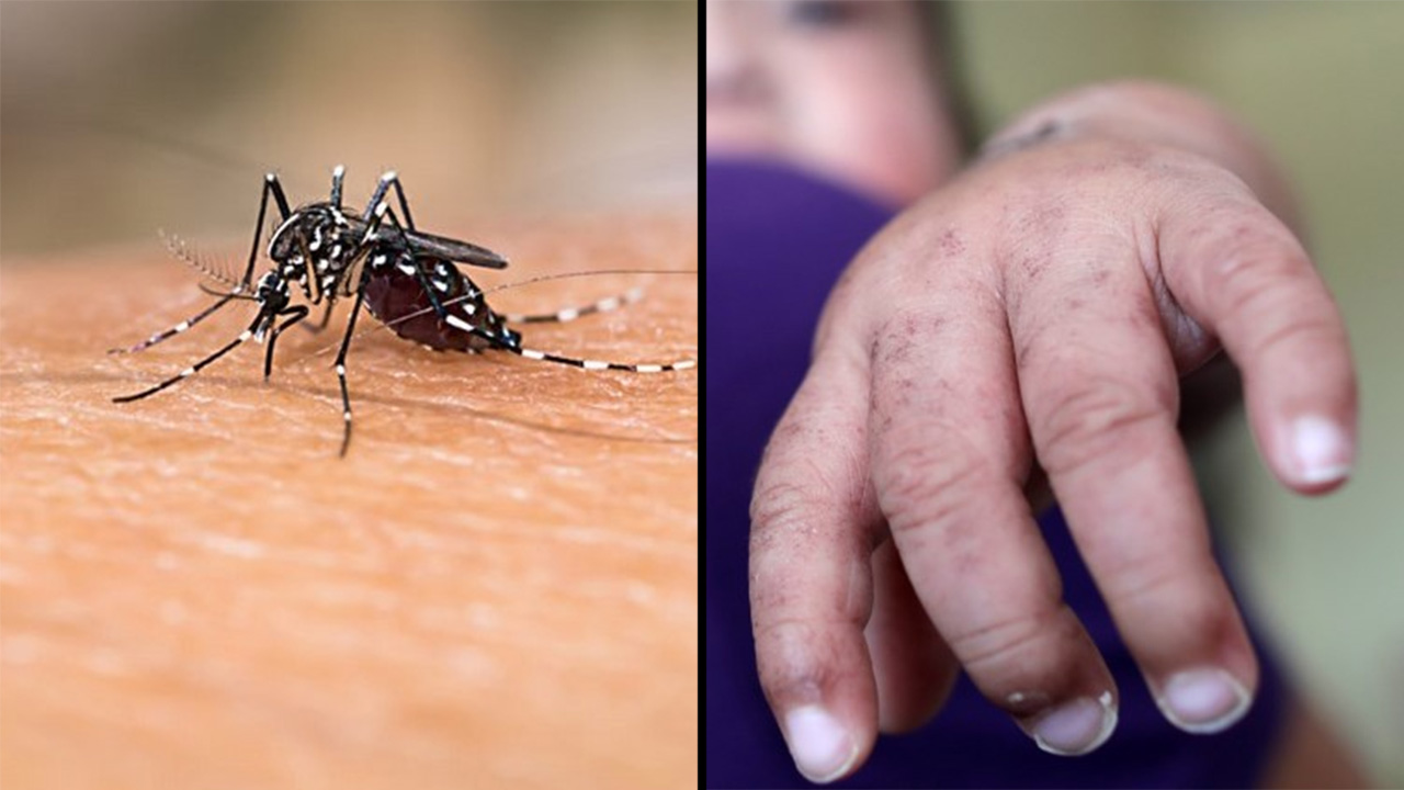Casos de dengue y sospechas de otros virus aumentan en el país