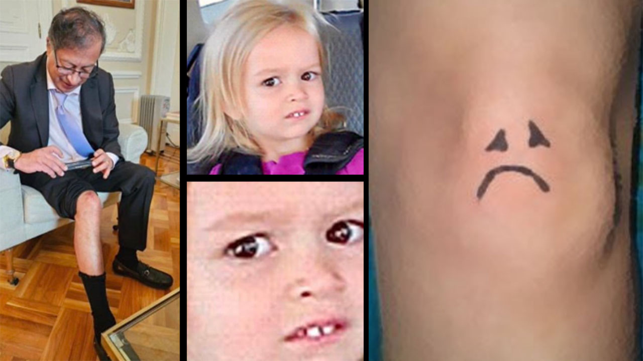 FOTOS Y VIDEO. RodillaChallenge, tendencia en redes sociales luego de que el presidente Petro mostrara el raspón tras caída en Cartagena