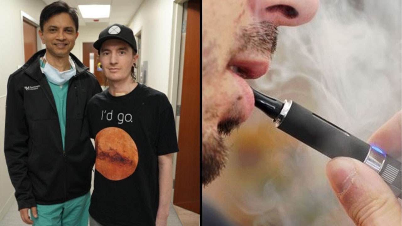 Por vapear perdió los pulmones, ahora tiene implantes mamarios