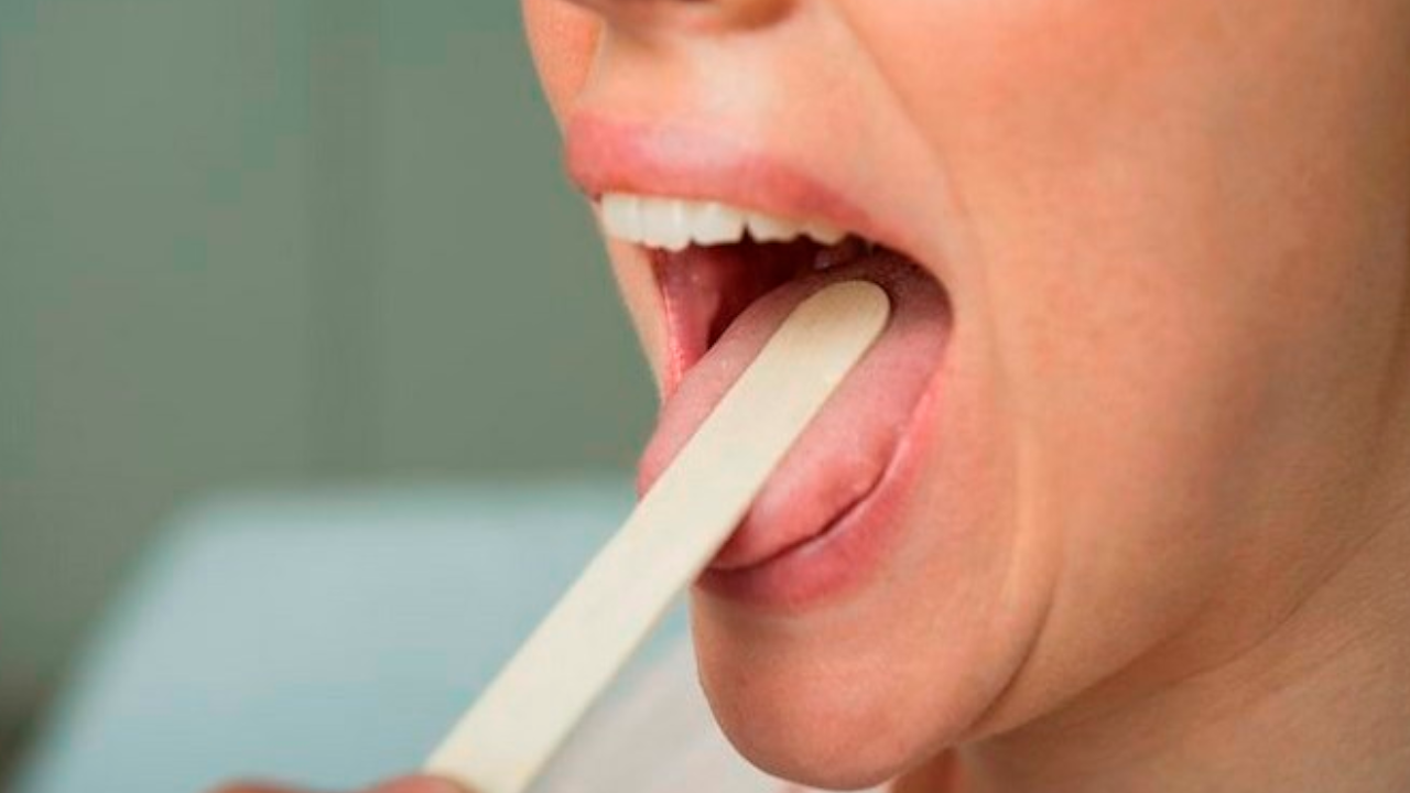 Una mujer quedó en coma por morderse la lengua