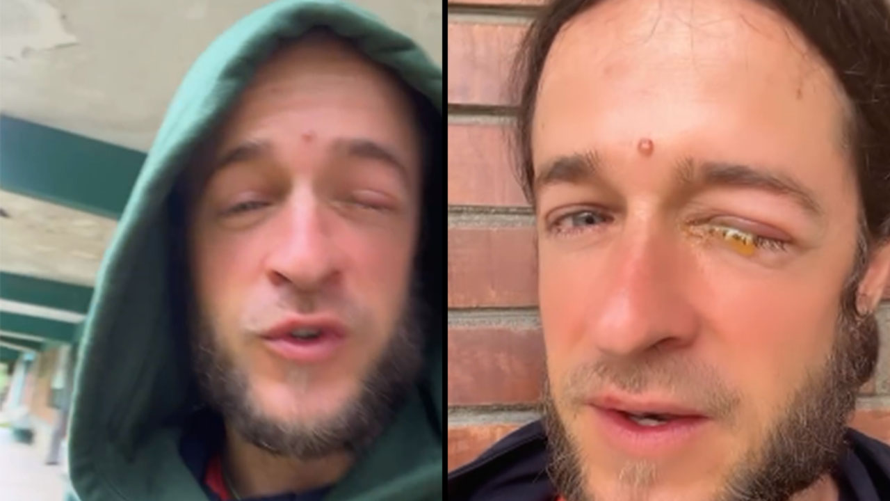 Exparticipante paisa del ‘Desafío’ tuvo un accidente en su ojo