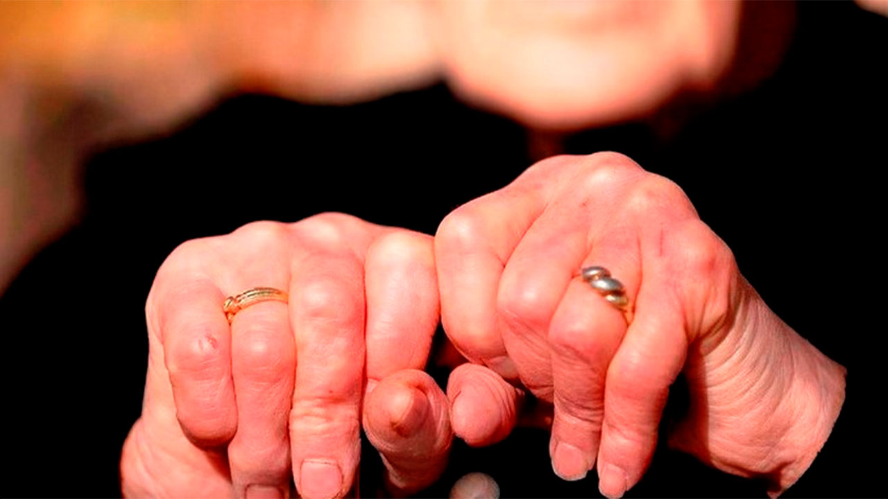 Lamentable suceso: adulta mayor pierde la vida en farmacia tras colapso repentino en Bello