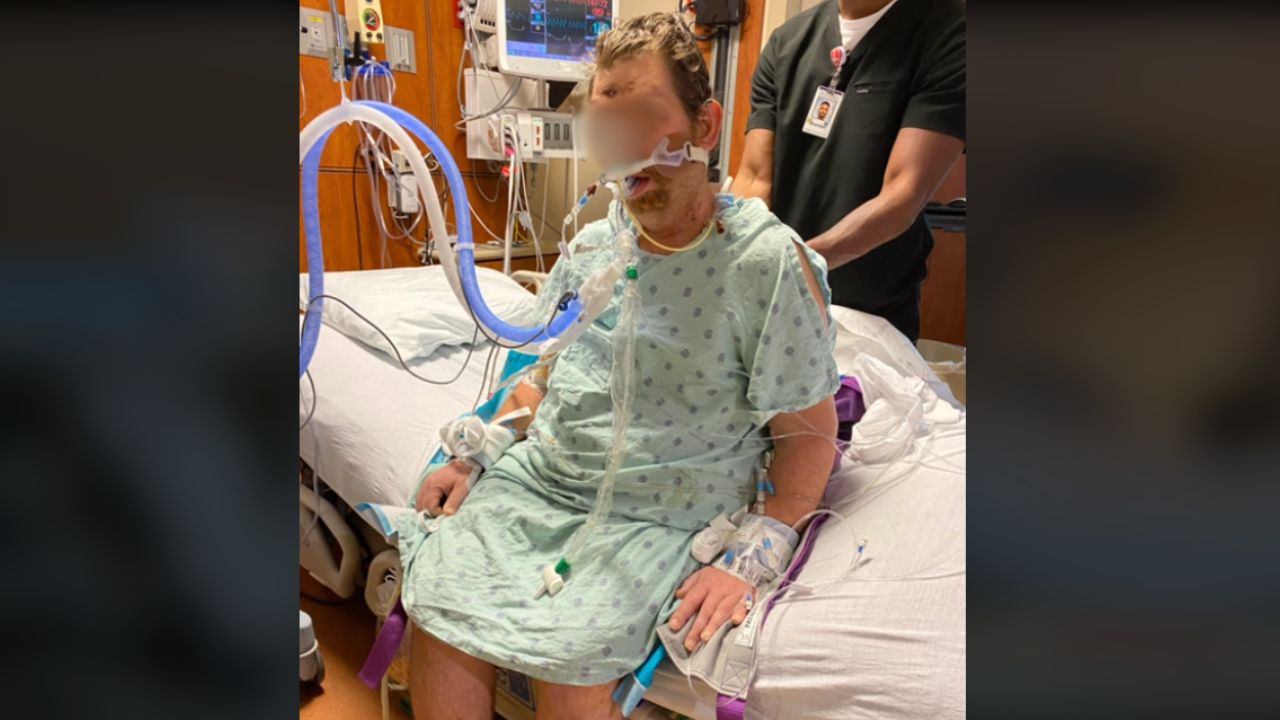 Hombre no le paró bolas a un pelo encarnado y quedó en coma