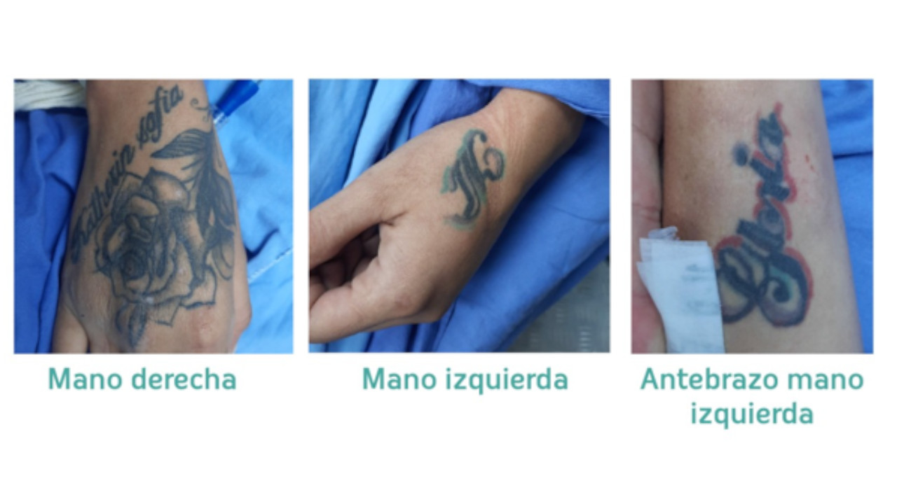 ¡Busca a los familiares! Mujer ingresó a urgencia de la clínica Antioquia