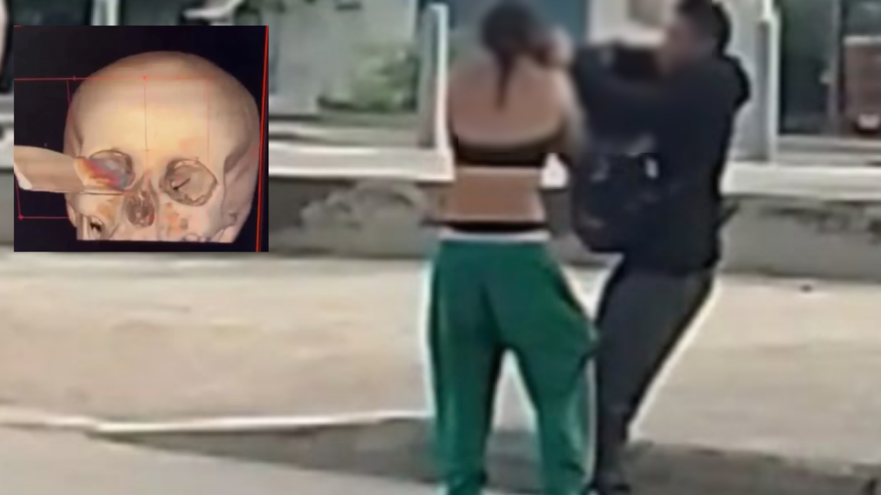 Adolescente paisa acabó con un cuchillo incrustado en su rostro