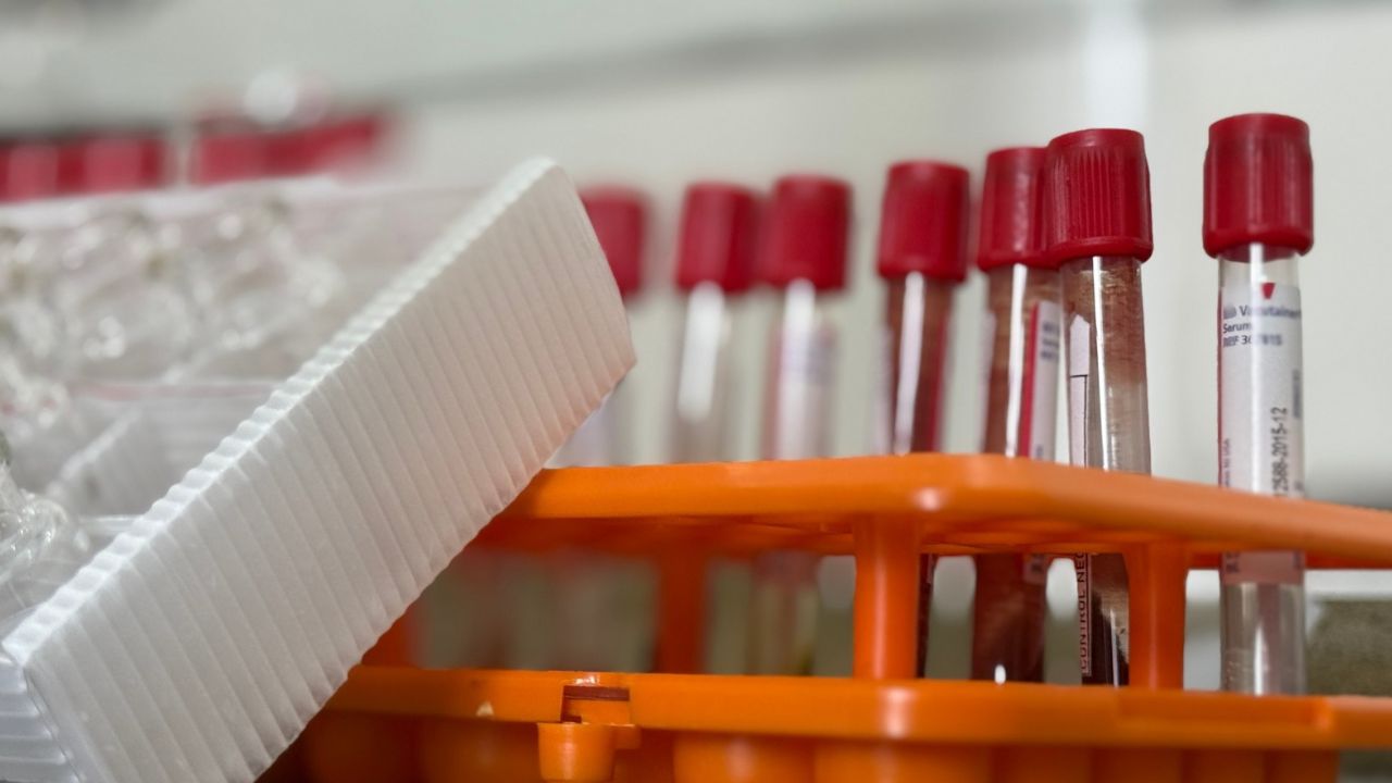 Potencian la lucha contra el crimen con nuevo cromatógrafo para investigaciones criminales