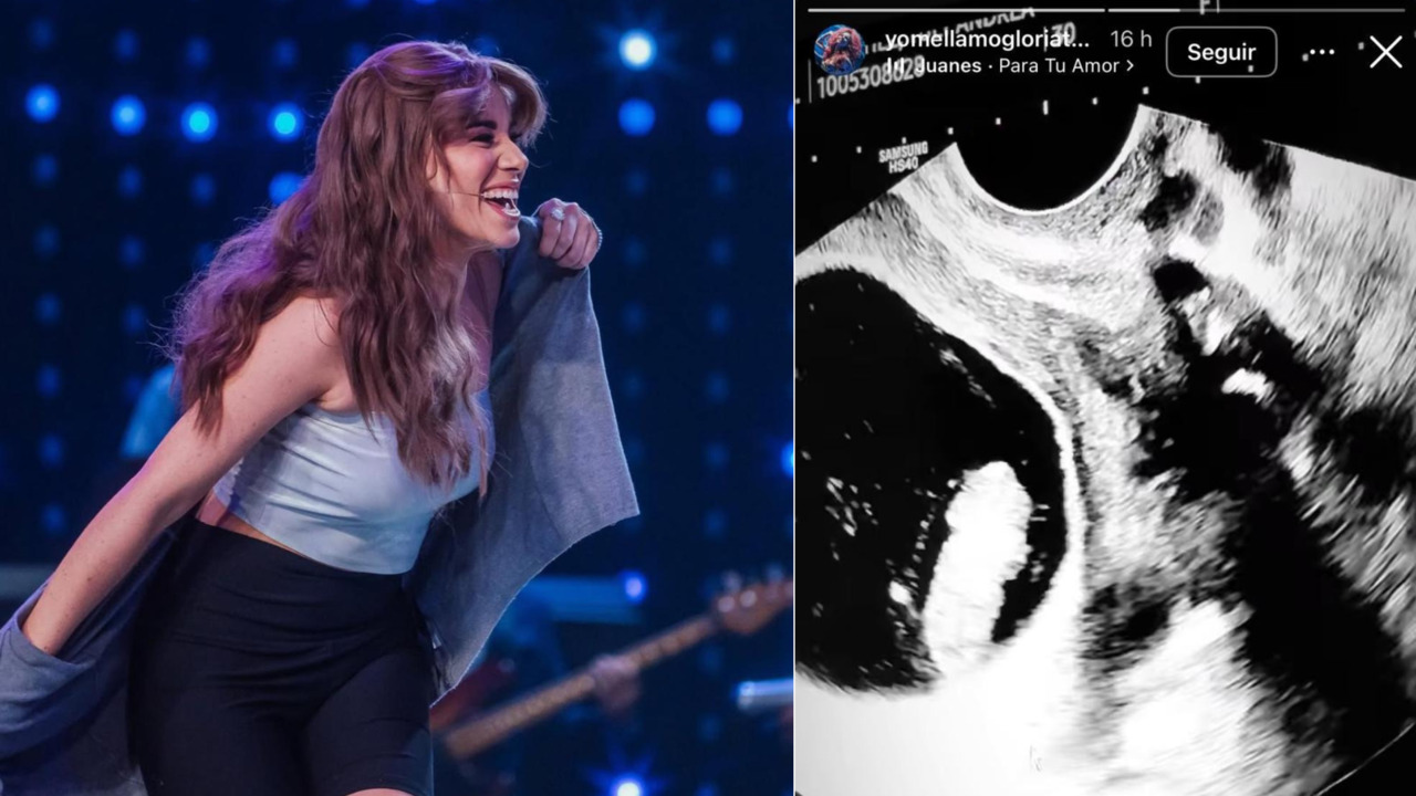 ¡Bebé en camino! Imitadores de Luis Alfonso y Gloria Trevi de 'Yo me llamo 2025' anuncian la llegada de su primer hijo