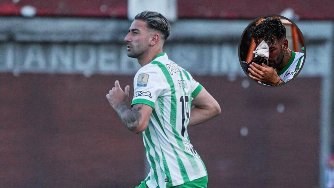 ¡Dura noticia para Atlético Nacional! Facundo Batista sufre fractura de tabique y será operado