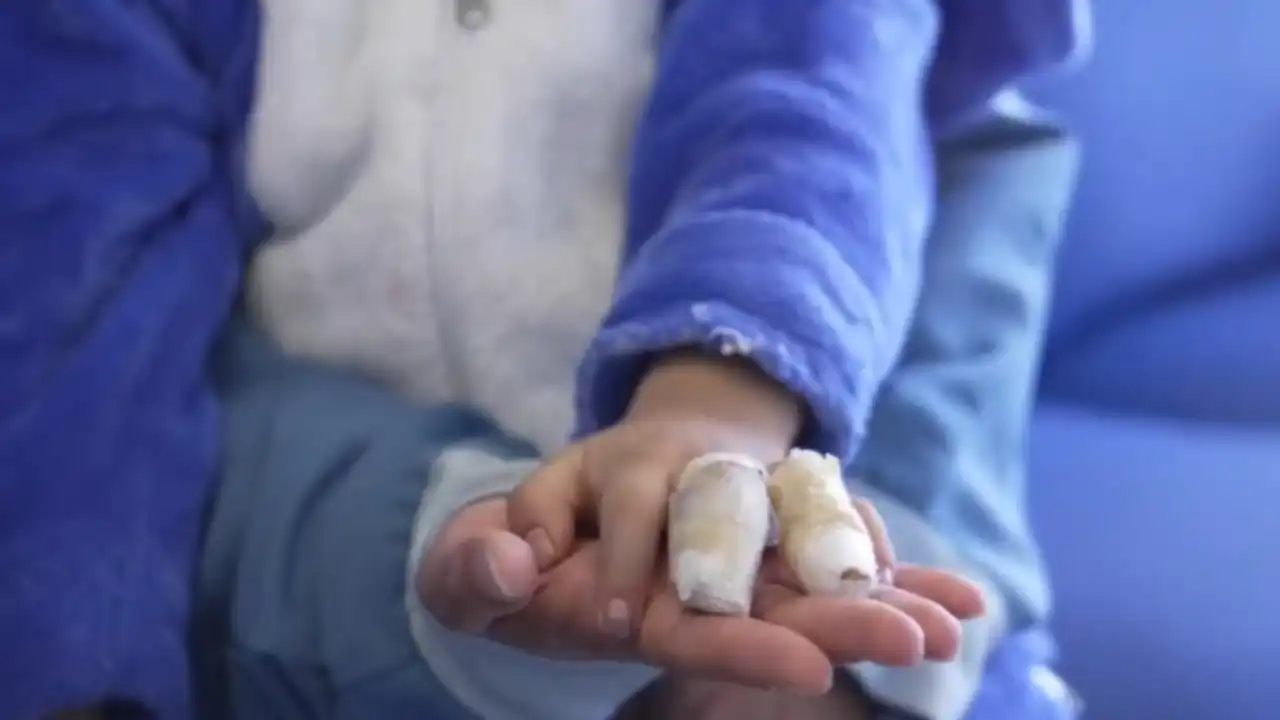 ‘¿Esperan que un hijo pierda un ojo?’: Fico Gutiérrez hace un llamado a los padres por quemaduras con pólvora