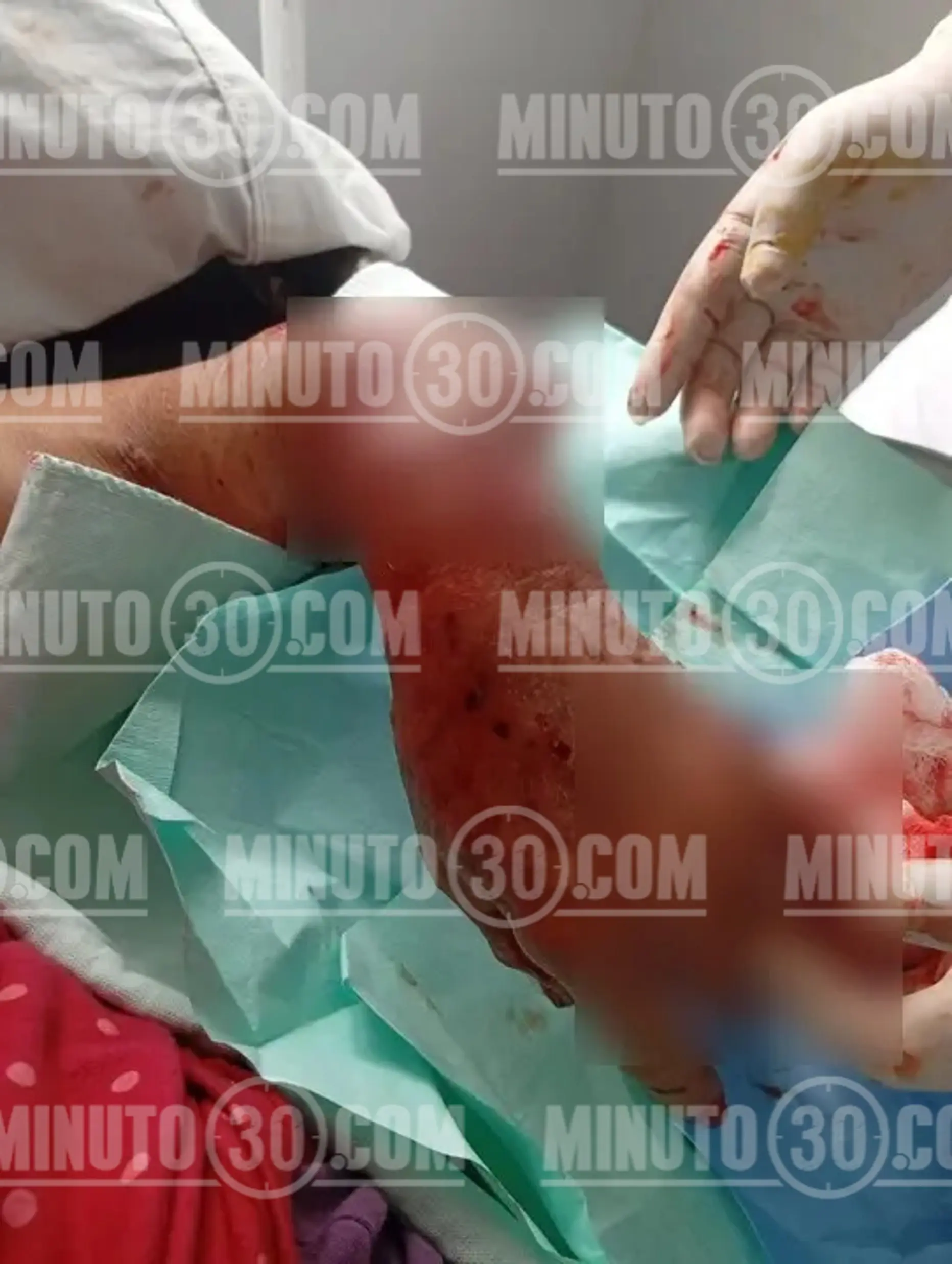 Perdió un dedo y parte del labio: salvaje ataque de dos perros a una adulta mayor en zona rural de Montebello 6 perro3 marca 1