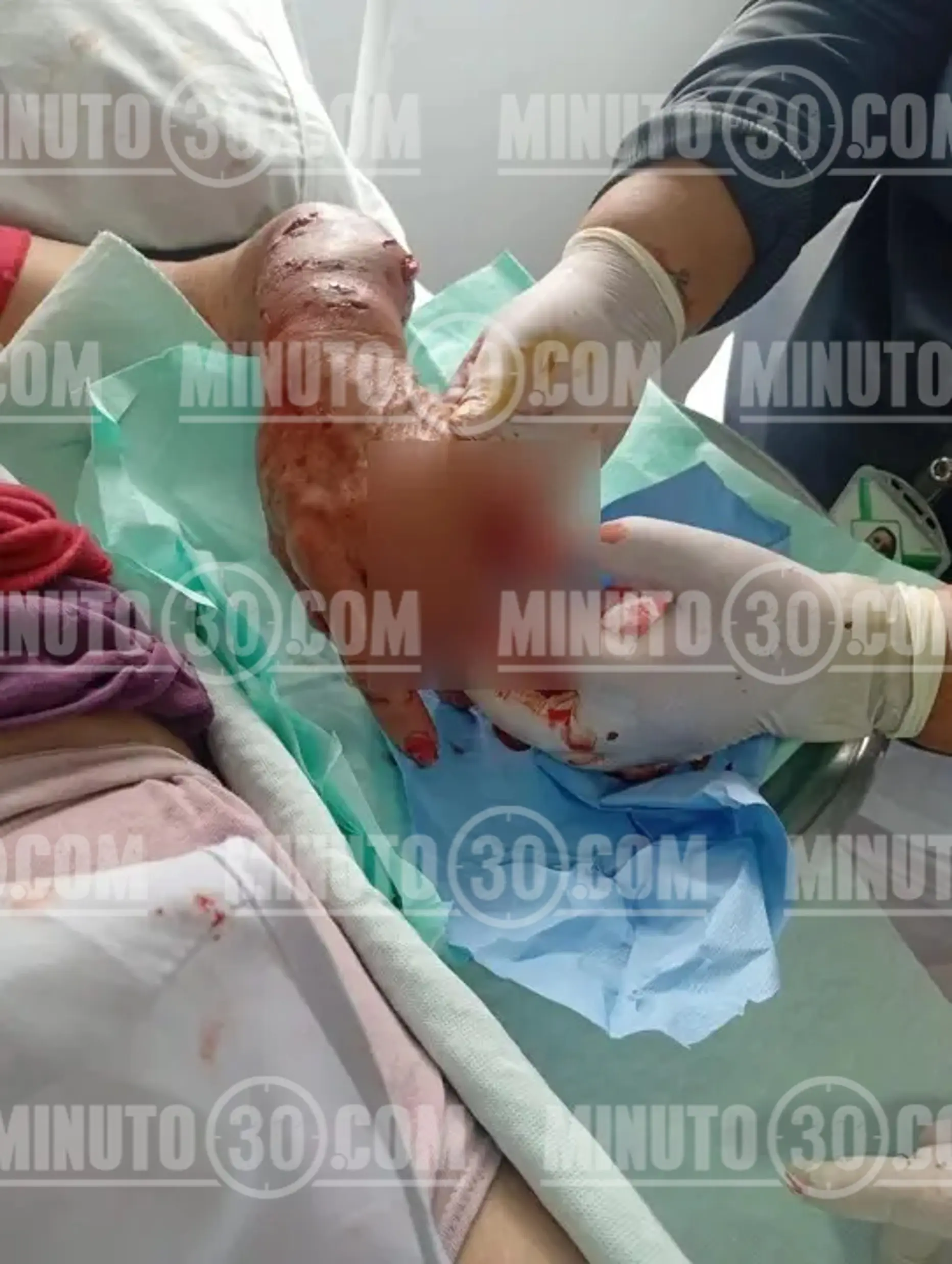 Perdió un dedo y parte del labio: salvaje ataque de dos perros a una adulta mayor en zona rural de Montebello 3 perro3 marca