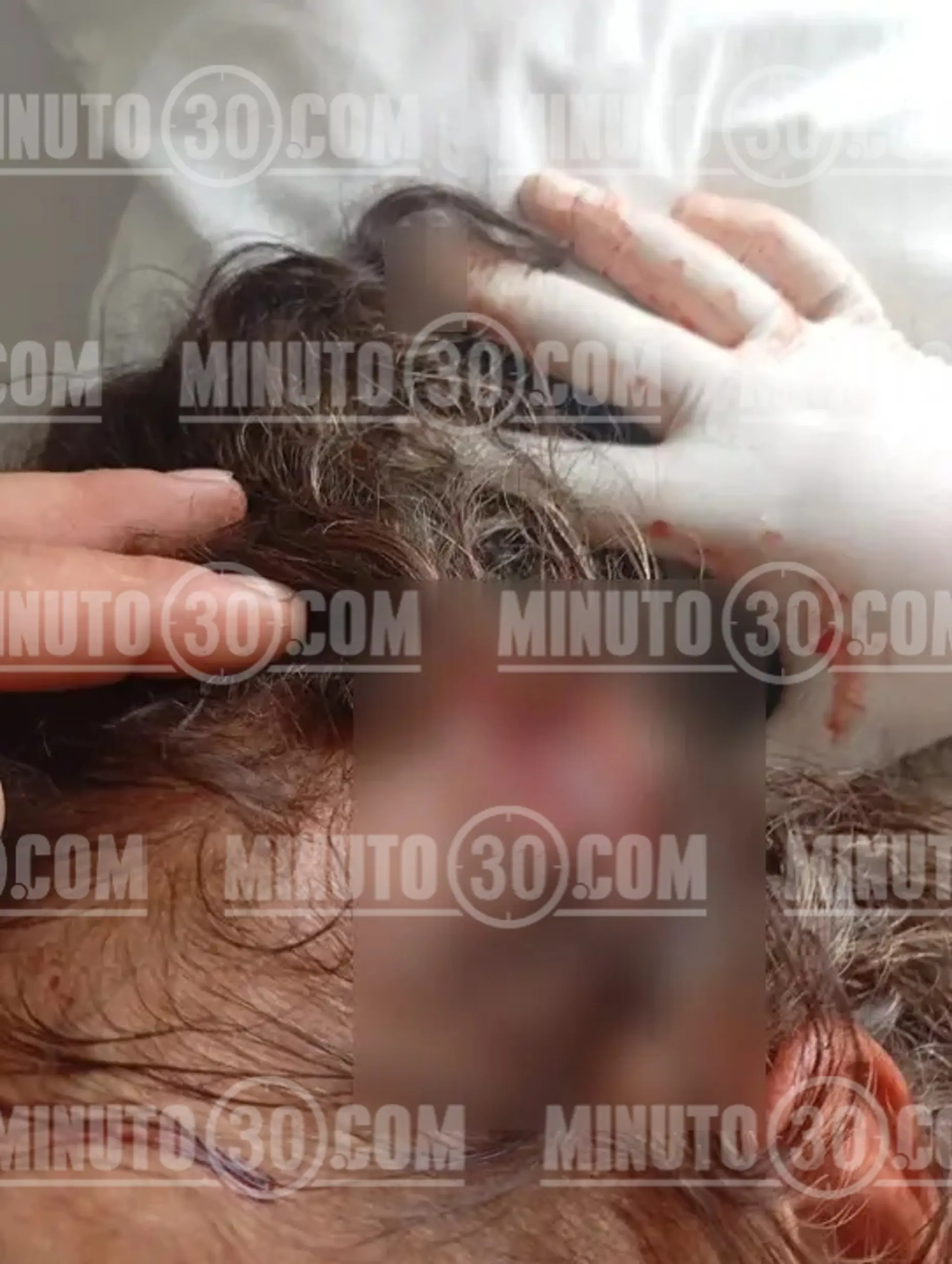 Perdió un dedo y parte del labio: salvaje ataque de dos perros a una adulta mayor en zona rural de Montebello 4 perro4 marca